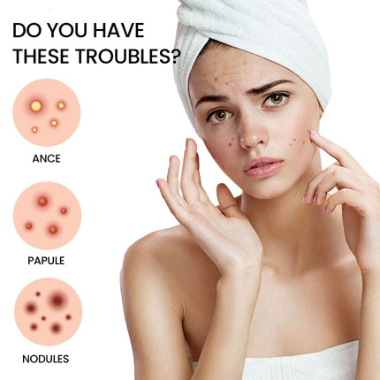 OUHOE Acne Patch, Repair Facial Acne Invisible Concealer Hydrocolloid Patch