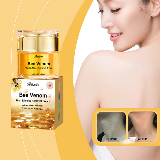 Ximonth Mole Removal Cream, A Gentle Herbal Cleanser And Mole Removal Repair Moisturizing Body Care Cream