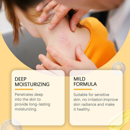 South Moon Skin Care Cream, Repair Epidermal Tissue To Relieve Discomfort Gentle Skin Care Body Cream