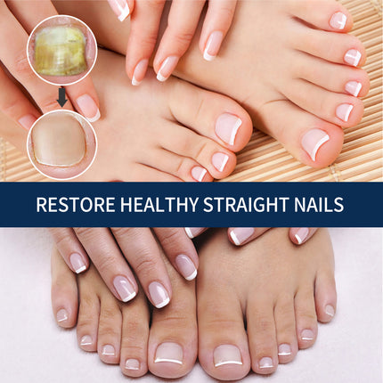 Nail Repair Relieve Essence Pen, Moisturizing Repair Hand And Foot Inlay Nail Thickening Grey Nail Correction Pen