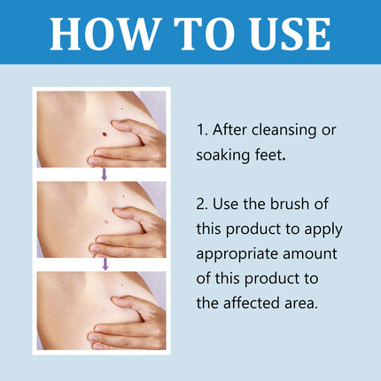Ximonth Quick Liquid, Brothers, Warts Corns Moles Skin Proud Flesh Smooth Skin Clean And Care