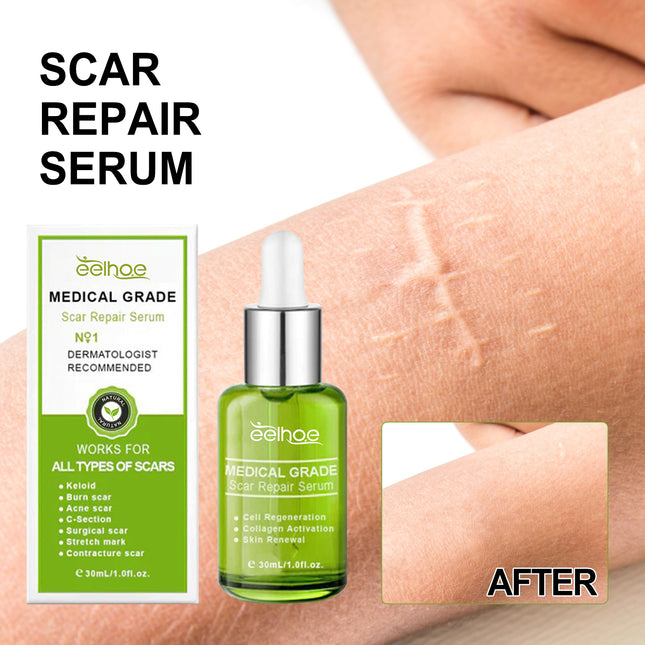 EELHOE Scar Repair Serum Reduces Scar Acne Mark Pregnancy Surgery Scar Repair Smooth Skin Care