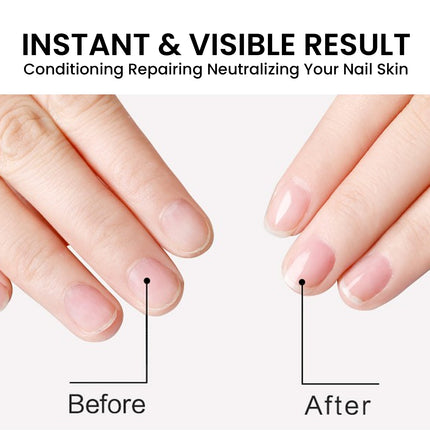 Nail Cuticle Oil, Repair Grey Nails Soft Nails Thickening Moisturizing And Brightening Nails Care Oil