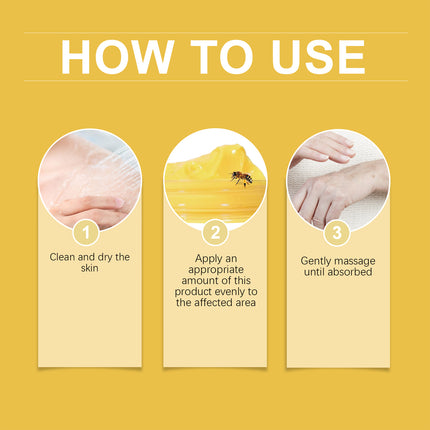 Houkea Bee Venom Joint Care Cream Gently Apply A Daily Topical Repair Cream For Wrist And Knee Massage And Body