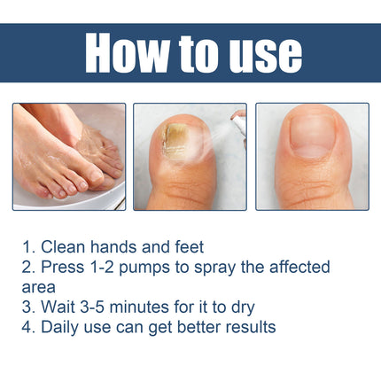 Nail Care Spray Gently Cleans Foot Nails Moisturizing And Brightening Nail Care Spray
