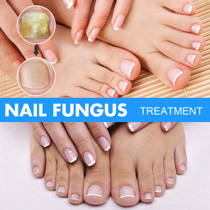Nail Repair Solution, Hand And Foot Gray Nail Care Repair Gray Nail Solution Thickening Soft Nails
