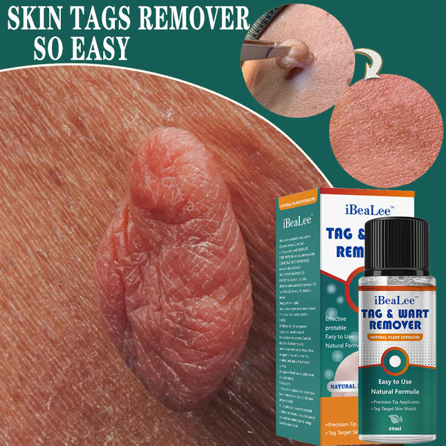 Flat and sharp warts, with a warm and moisturizing facial warts remover