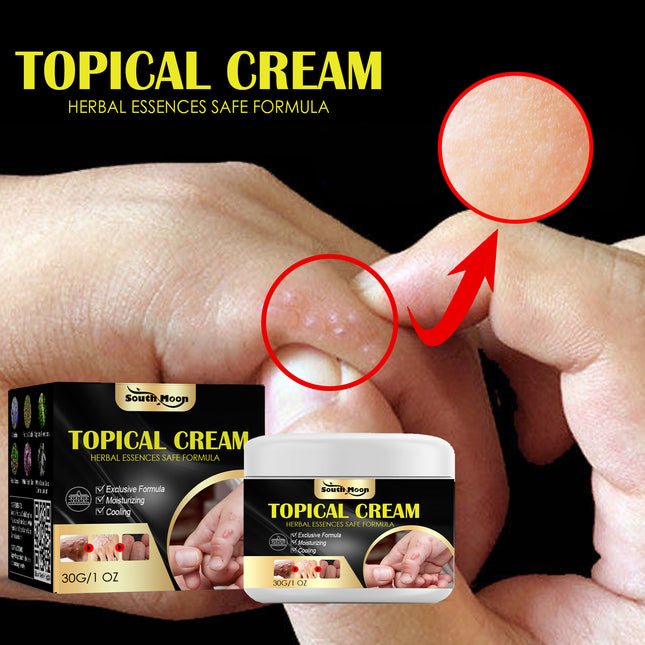 South Moon Anti-Itch Cream For Sweat Blister, Anti-Itch Cream For Dry, Itchy Skin, Anti-Itch Cream For Mosquito Bites And Repair Cream