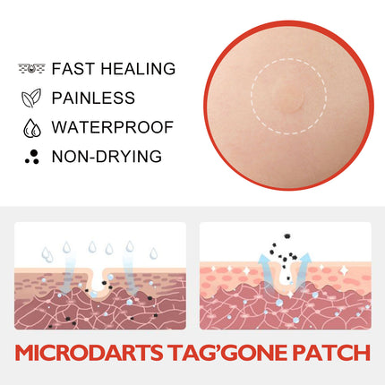 OUHOE Acne Patch, Skin Clean Acne Pimple Moles Gram Wart Corns Spot Patch