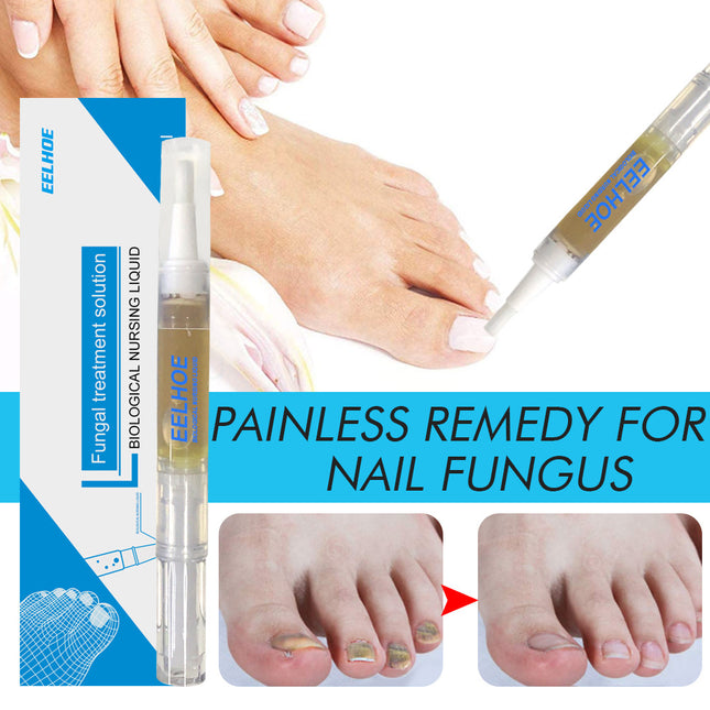 EELHOE Nail Care Solution Hand, Foot And Nail Care Clean Soft Nails Daily Gentle Moisturizing And Curing Polish Solution
