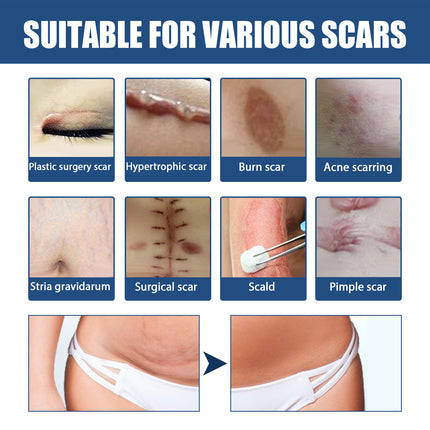 Scar Balm, Surgery Scar Repair Cold Compress Scar Skin Scar Gel Balm
