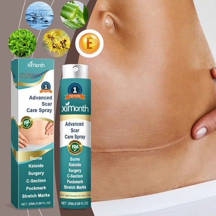 Ximonth Skin Repair Spray Gently Moisturizes Smooth, Moisturizing And Repairing Skin Care Spray