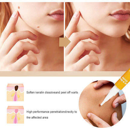 EELHOE Skin Repair Liquid Pen (2 Pieces) Gently Repairs And Smooths Body Skin, Neck And Face Skin Care Pen