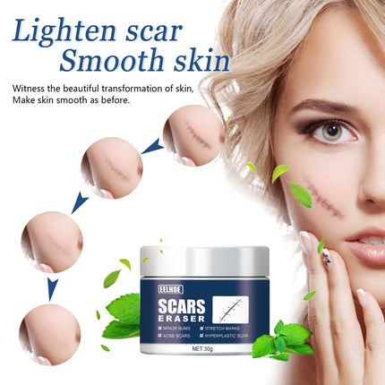 EELHOE Scar Balm, Surgery Scar Repair Cold Compress Scar Skin Scar Gel Balm