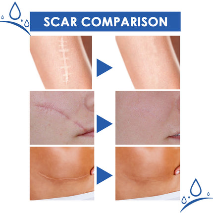 Jaysuing Scar Cream, Fade Scars Smooth And Firming Skin Repair Cream