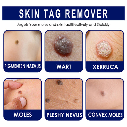 South Moon Warts Biconk Wart Liquid, Remove Flat Especially Face Eye Remove Ordinary Flat Especially