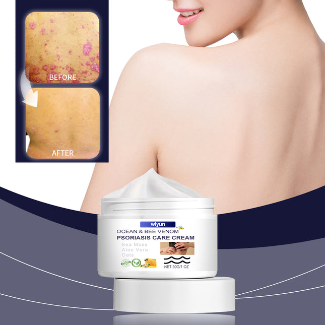 Wiyun Bee-Venom Cowhide Moss Care Cream, Relieve Hands And Feet Skin Itching Discomfort Moisturizing Skin Cooling Care Cream