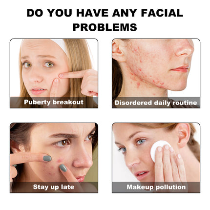 Yellow Acne Patch Mild Ingredients Moisturize, Moisturize, Cleanse And Care For Facial Acne Patches