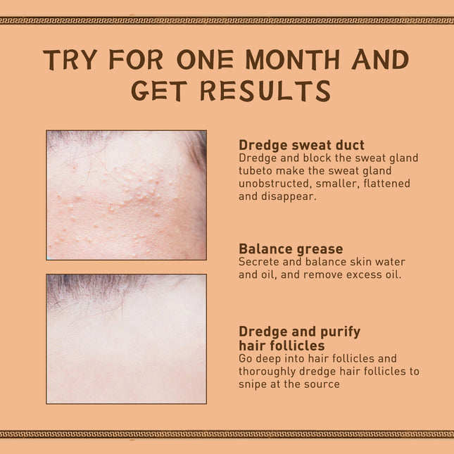 EELHOE Gentian Eye Cream, Improve Eye Fat Granules Firming Fine Line Around Eye Bags Moisture Lock Eye Cream