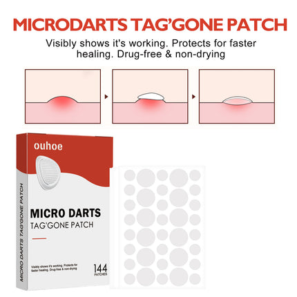 OUHOE Acne Patch, Skin Clean Acne Pimple Moles Gram Wart Corns Spot Patch