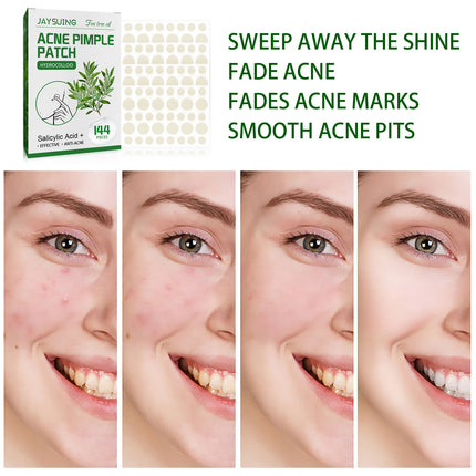 Waterproof Invisible Acne Patch Lighten Acne Acne Print Moisturizing Repair Clear Patch