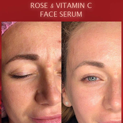 Anti-Wrinkle Facial Serum with Rose Water & Vitamin C
