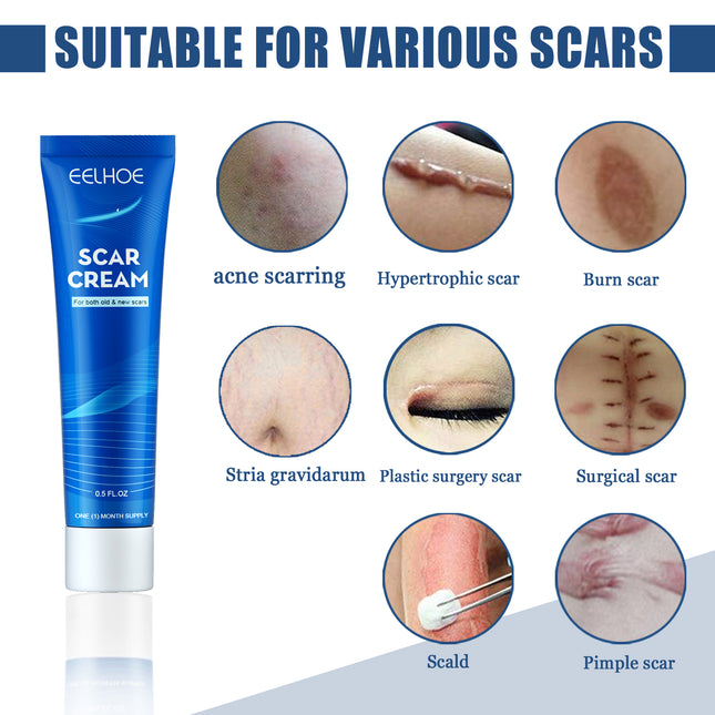 EELHOE Skin Care Cream Gentle Care External Body Care Moisturizing Smooth Skin Care Cream