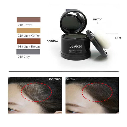 Forehead Sparse Hair Concealment and Contouring Hairline Filler