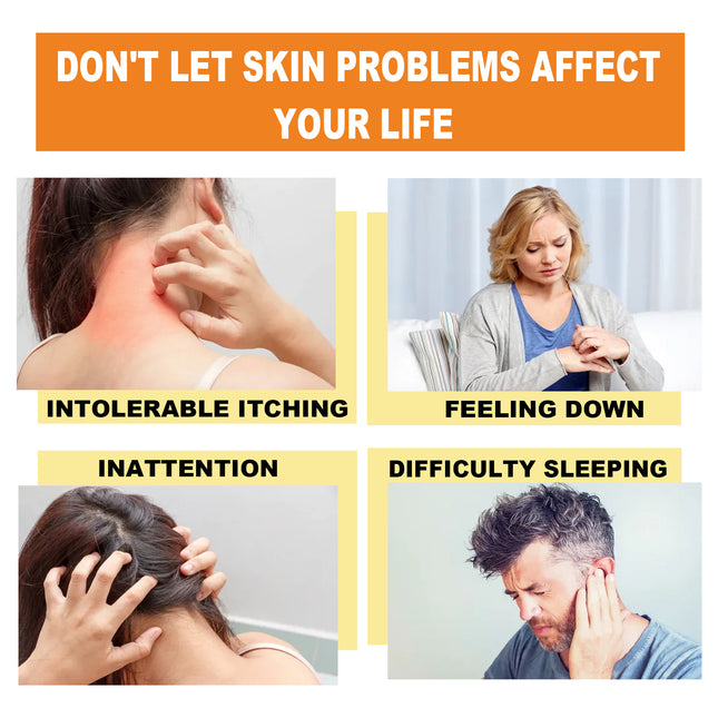 Bee Venom Psoriasis Cream, Relieve Itchy Skin Repair Hand Moss Moisturizing Skin Care Cream