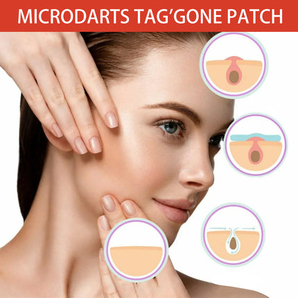 OUHOE Acne Patch, Skin Clean Acne Pimple Moles Gram Wart Corns Spot Patch