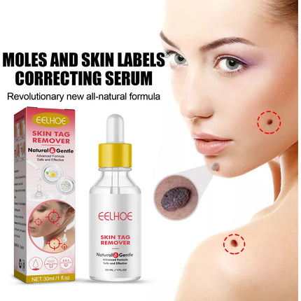 Wart Essence Removes Dark Moles Flesh Moles Repair Skin Neck Flesh Grains Flat Especially Corns Remove Warts