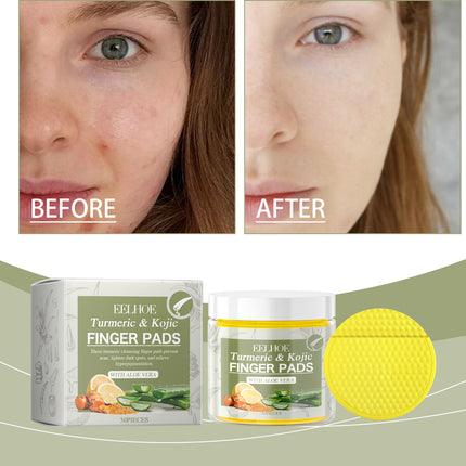 EELHOE Turmeric Acid Cleanser, Soothing And Refreshing To Clean Pores, Pimples, Closed Mouth And Delicate Skin