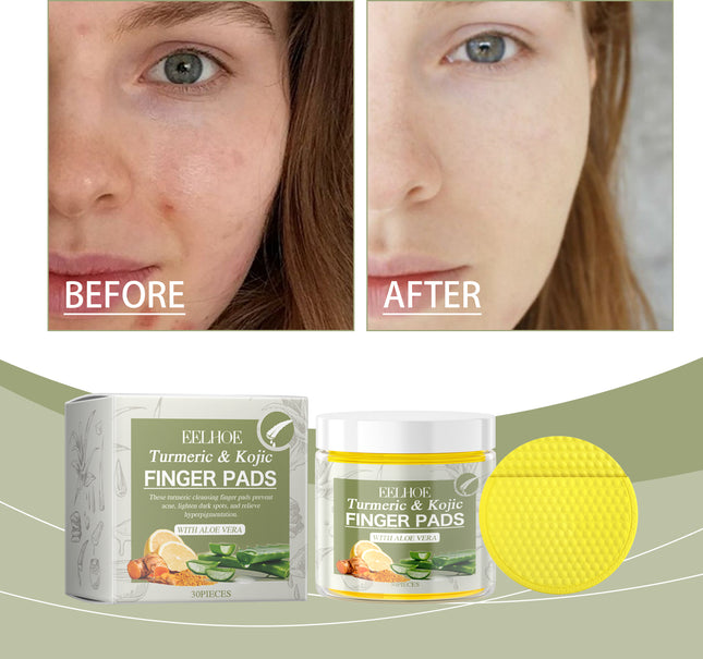 EELHOE Turmeric Acid Cleanser, Soothing And Refreshing To Clean Pores, Pimples, Closed Mouth And Delicate Skin
