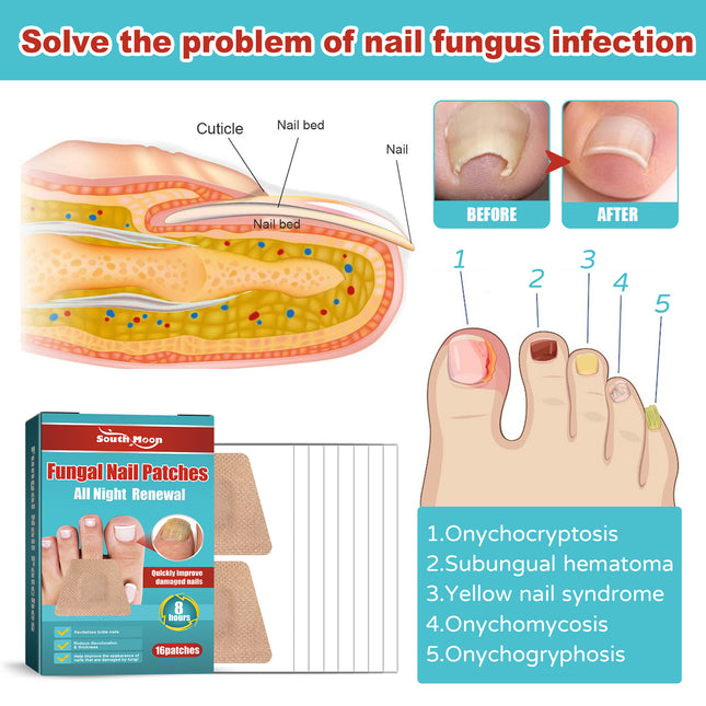South Moon Nail Care Night Patch Nail Moisturizing And Brightening Care Soft Nail Thickening Nail Patch