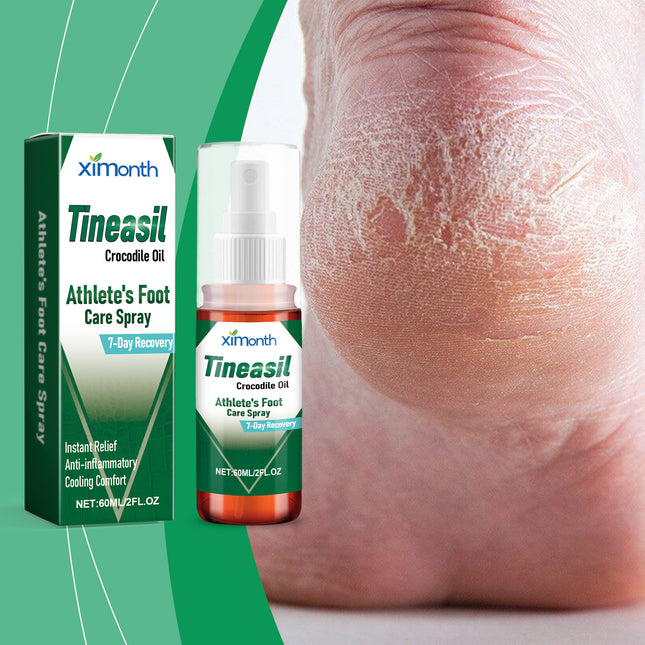 Ximonth Foot Skin Care Spray Foot Moisturizing, Cleaning, Deodorizing And Repairing Skin Spray