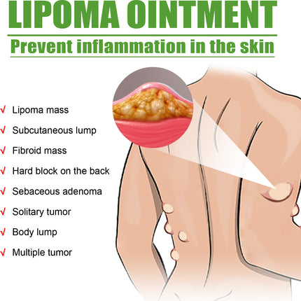 Fat Binding Cream, Dredge Body Of Many Kinds Of Fat Caking Tumor Subcutaneous Lumps Body Care Cream