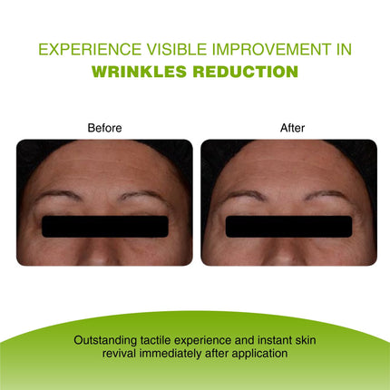 Vijuve Vitamin C Face Serum with Double Hyaluronic Acid and Collagen