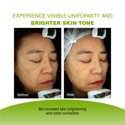 Vijuve Vitamin C Face Serum with Double Hyaluronic Acid and Collagen