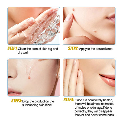 Wart Essence Removes Dark Moles Flesh Moles Repair Skin Neck Flesh Grains Flat Especially Corns Remove Warts