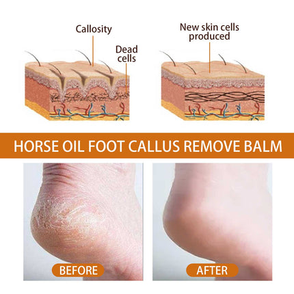 OUHOE Horse Oil Foot Care Cream, Repair Heel Peeling Anti-Cracking Moisturizing Foot Care Cream