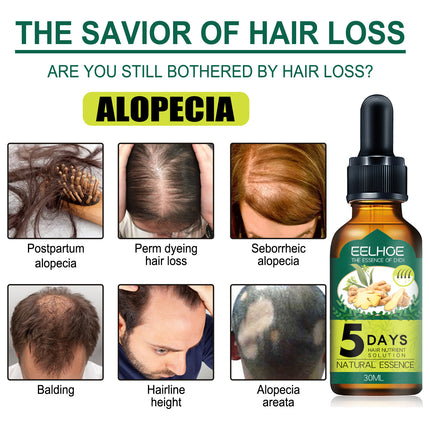 EELHOE Ginger Hair Essential Oil Moisturizes And Softens Hair And Repairs Frizzy Damaged Hair
