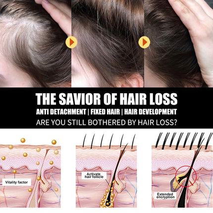 West&Month Hair Loss Plant Moisturizing Tonic, Repair Strong Moisturizing Roots Thick Supple Hair Care Essential Oil