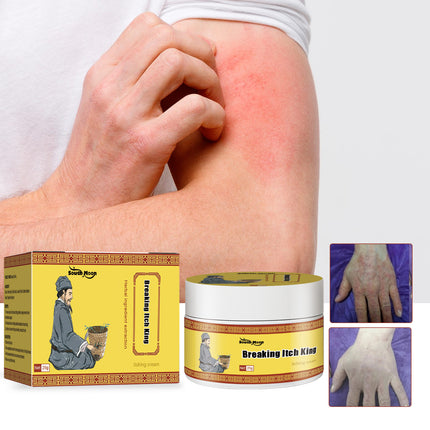 South Moon Breaking Itch King, Relieve Hand And Foot Moss Skin Moss Redness Repair Skin Itching Skin Care Cream