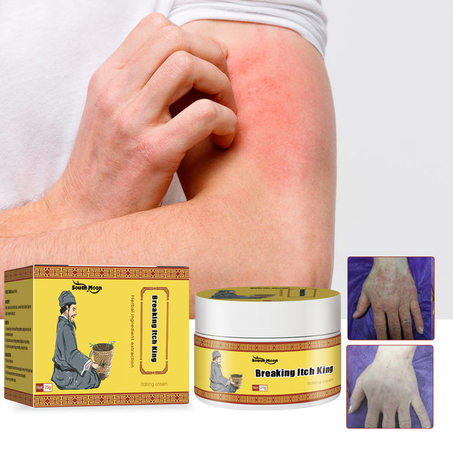 South Moon Breaking Itch King, Relieve Hand And Foot Moss Skin Moss Redness Repair Skin Itching Skin Care Cream