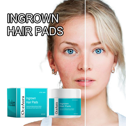 Ingrown Hair Pads, Lighten Acne Repair Delicate Pores Compact Smooth Skin Moisturizing