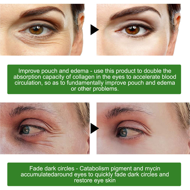 Seaweed Firming Eye Mask, Gentle Moisturizing, Nourishing And Caring Eye Mask For Daily Eye Care