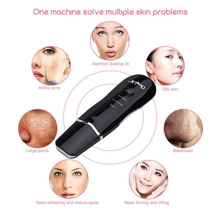 Ultrasonic Skin Scrubber Facial Cleaning Peeling Shovel Lifting