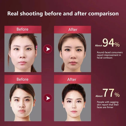 CAMMUO Facial Lifting Massager 12 Gears Electric Facial Massager V-line Face Lifting Slimming Vibration Device Home Use Beauty Tool - White