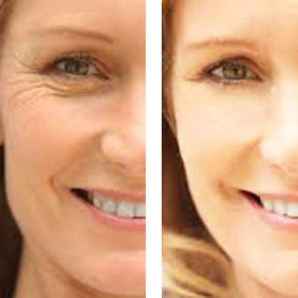 Age Defense : Eye Wrinkle Cream + Vitamin C Serum