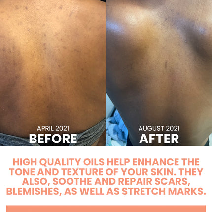 REPLENISH Body Oil